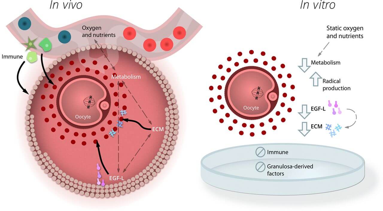 In Vitro Maturation (IVM)